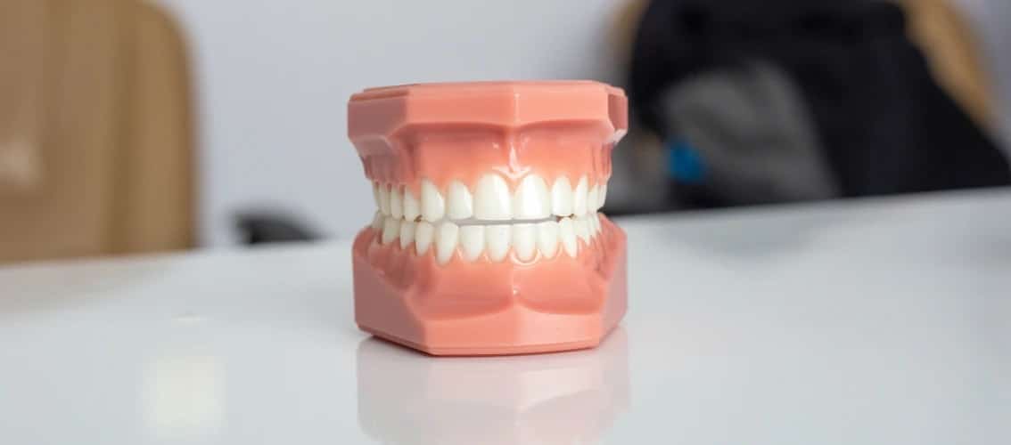A dental mold sits on a table