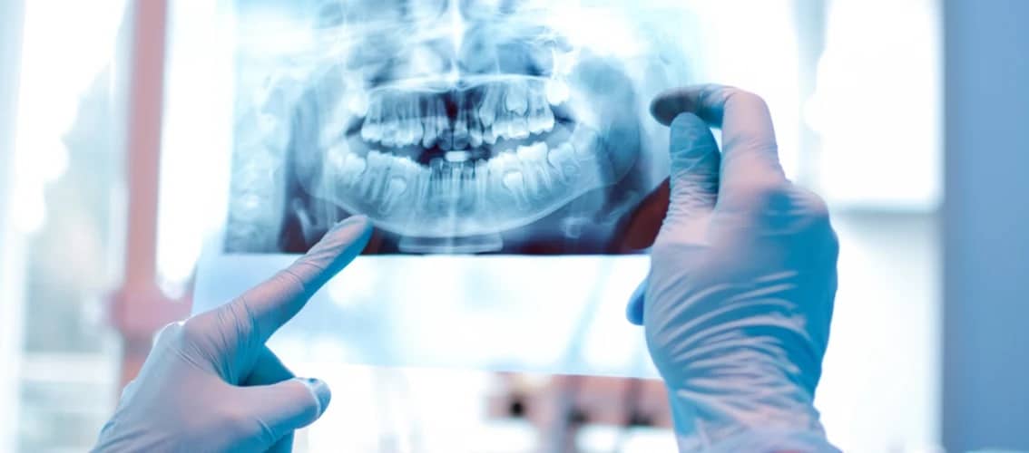 disability-insurance-dentists_z6ejhn