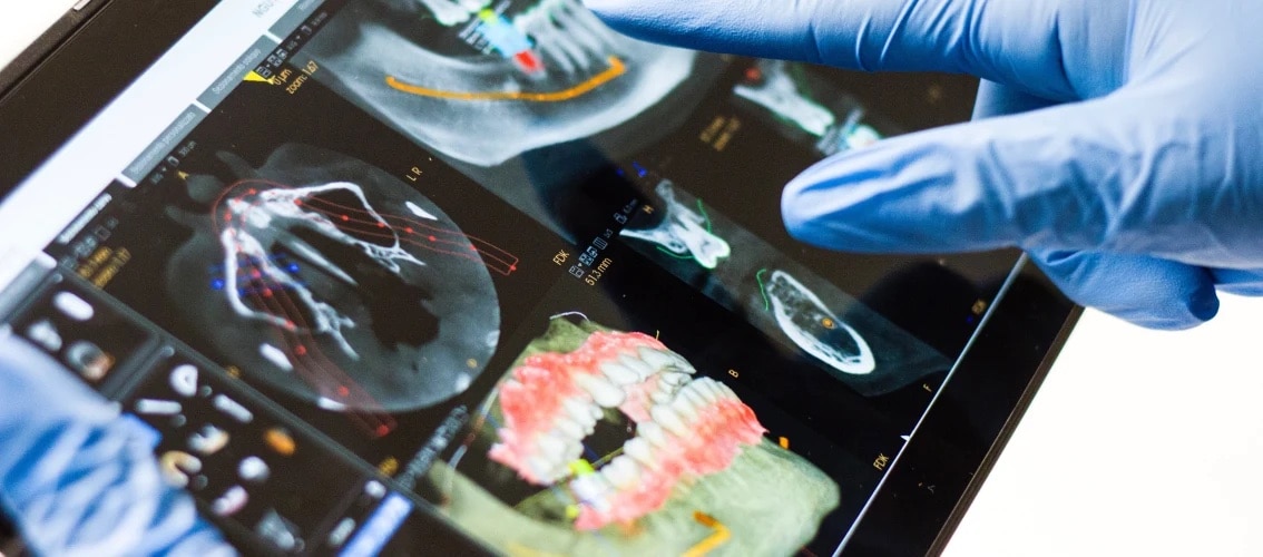 Gloved hands interact with dental scans on tablet