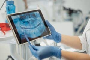 Dentist reviewing patient x-rays