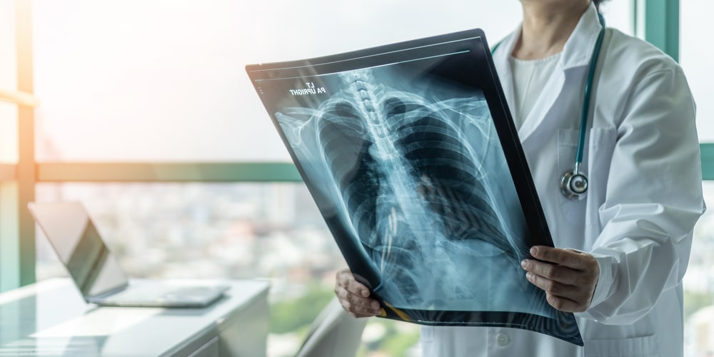 doctor holding a radiological chest x-ray